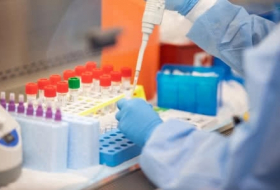 Стоимость проведения PCR-теста в частных клиниках составит 150 лари