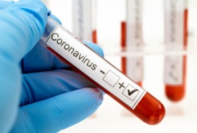 Число выявленных случаев заражения коронавирусом в Грузии за сутки увеличилось на 15